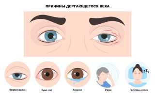 По какой причине дергается нерв под глазом